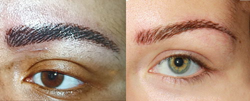 Permanent Makeup